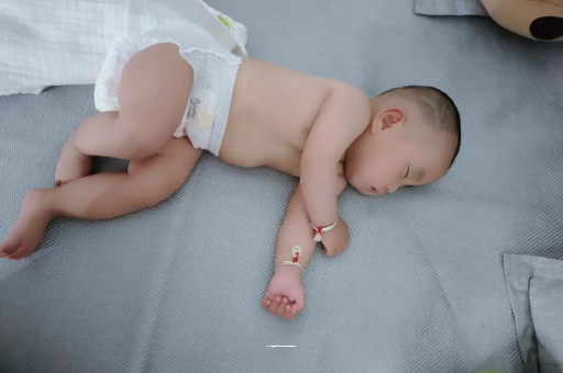 自贡六个月宝宝眼睛散光